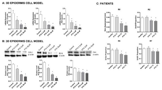 Fibronectin Antibody in Western Blot (WB)