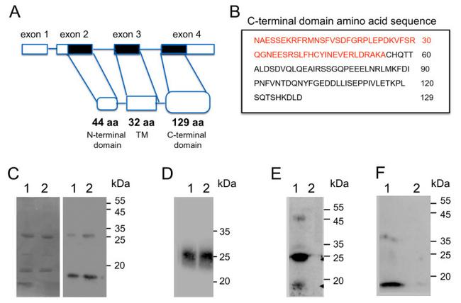 MRAP2 Antibody in Western Blot (WB)