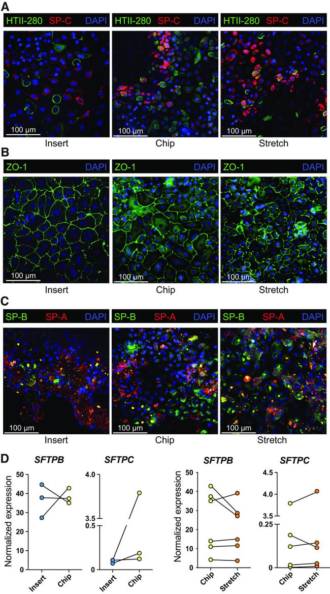 SFTPB Antibody in Immunohistochemistry (IHC)