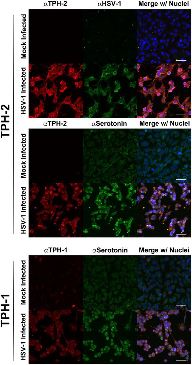 TPH1 Antibody in Immunocytochemistry (ICC/IF)