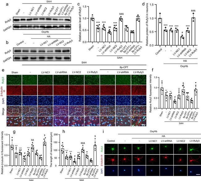 RIPX Antibody in Western Blot, Immunocytochemistry, Immunohistochemistry (WB, ICC/IF, IHC)