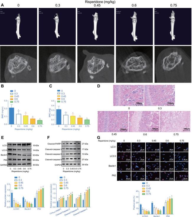 LC3A Antibody in Immunohistochemistry (IHC)