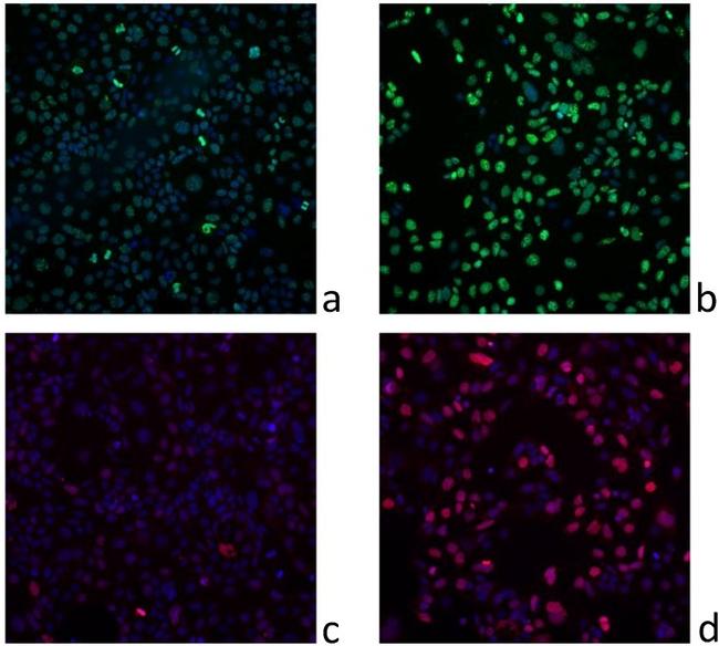 Phospho-Histone H2A.X (Ser139) Antibody in Immunocytochemistry (ICC/IF)