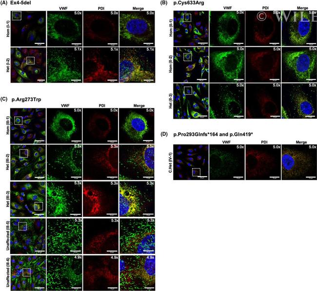 PDI Antibody in Immunocytochemistry (ICC/IF)