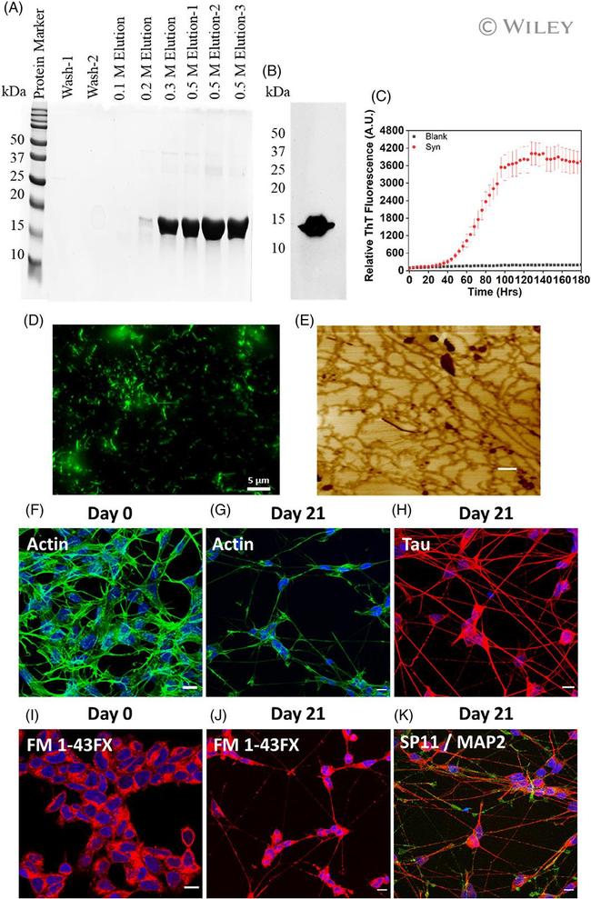 Synaptophysin Antibody in Immunocytochemistry (ICC/IF)