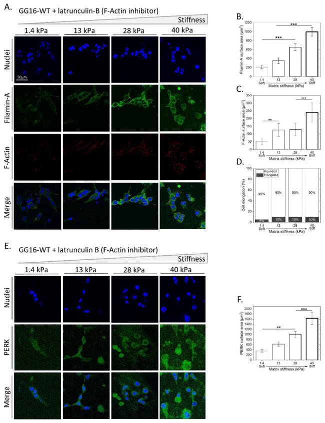 Filamin A Antibody in Immunocytochemistry (ICC/IF)