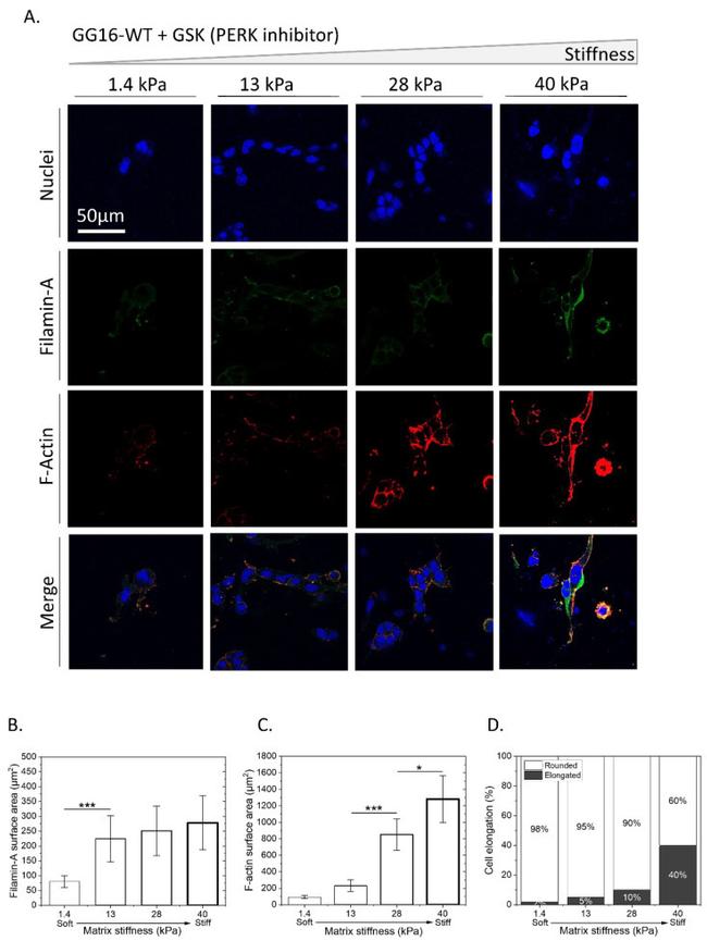 Filamin A Antibody in Immunocytochemistry (ICC/IF)