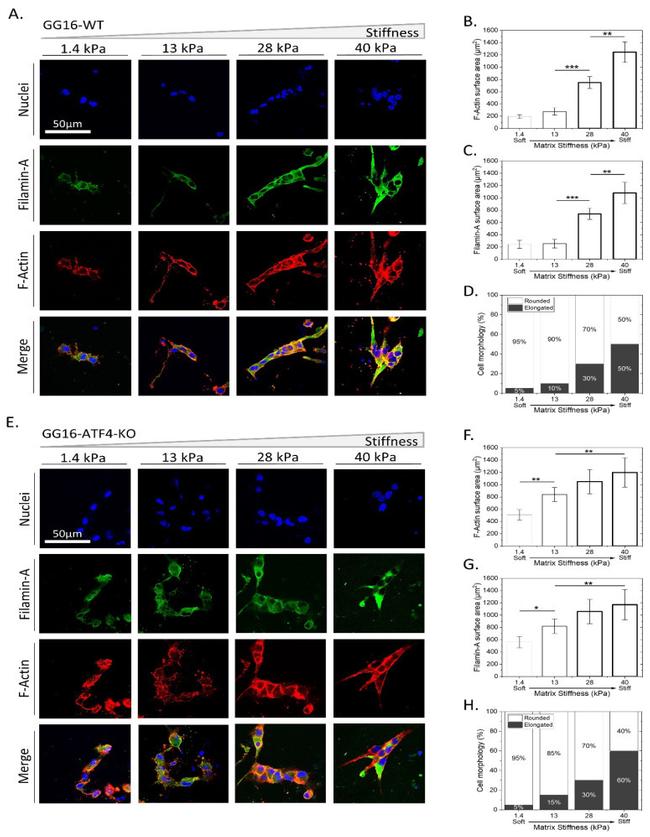 Filamin A Antibody in Immunocytochemistry (ICC/IF)