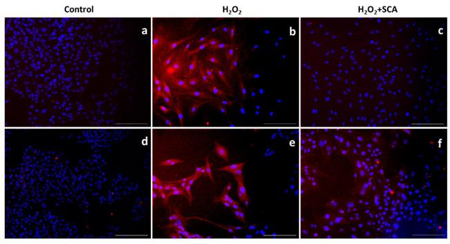 mTOR Antibody in Immunocytochemistry (ICC/IF)