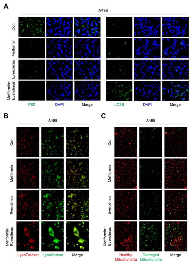 SQSTM1 Polyclonal Antibody (PA5-27247)