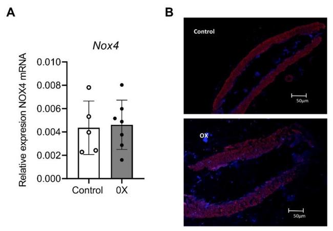 NOX4 Antibody in Immunohistochemistry (IHC)