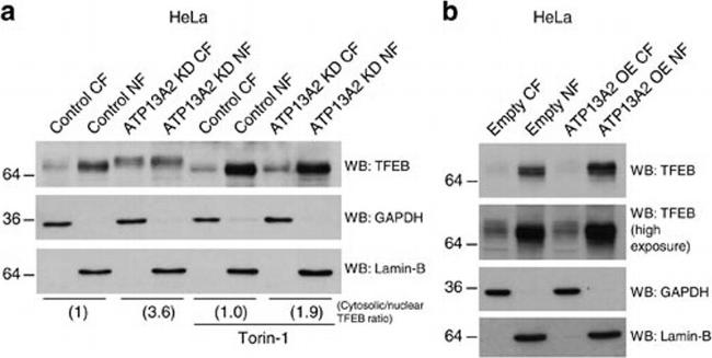 Goat IgG (H+L) Secondary Antibody in Western Blot (WB)