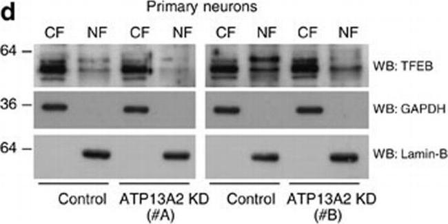 Goat IgG (H+L) Secondary Antibody in Western Blot (WB)