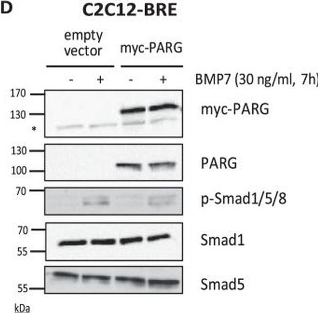 Rabbit IgG (H+L) Secondary Antibody in Western Blot (WB)