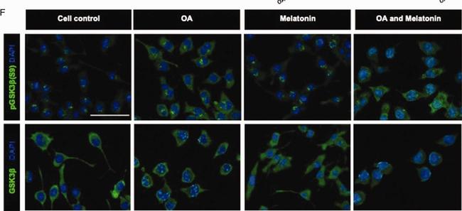 Goat anti-Rabbit IgG (H+L) Cross-Adsorbed, Alexa Fluor™ 555 (A-21428)