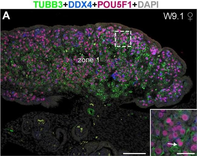 Goat IgG (H+L) Cross-Adsorbed Secondary Antibody in Immunohistochemistry (IHC)