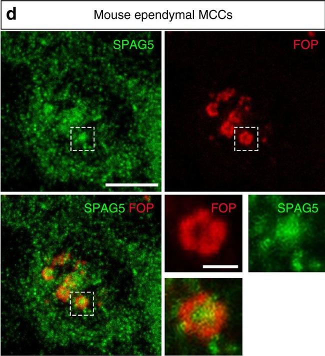 Mouse IgG2b Cross-Adsorbed Secondary Antibody in Immunocytochemistry (ICC/IF)