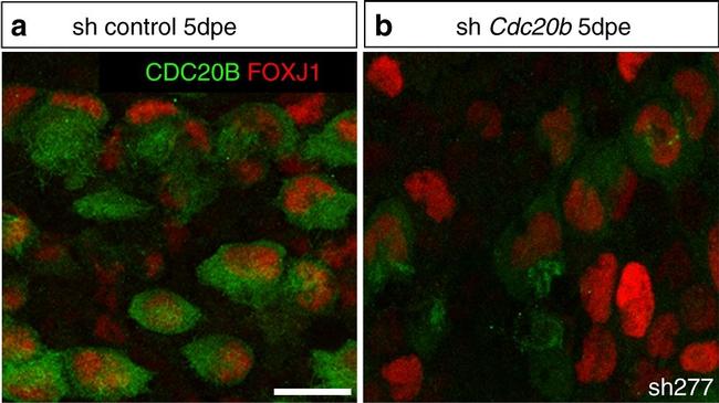 Mouse IgG2b Cross-Adsorbed Secondary Antibody in Immunocytochemistry (ICC/IF)