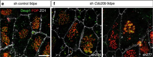 Mouse IgG1 Cross-Adsorbed Secondary Antibody in Immunocytochemistry (ICC/IF)