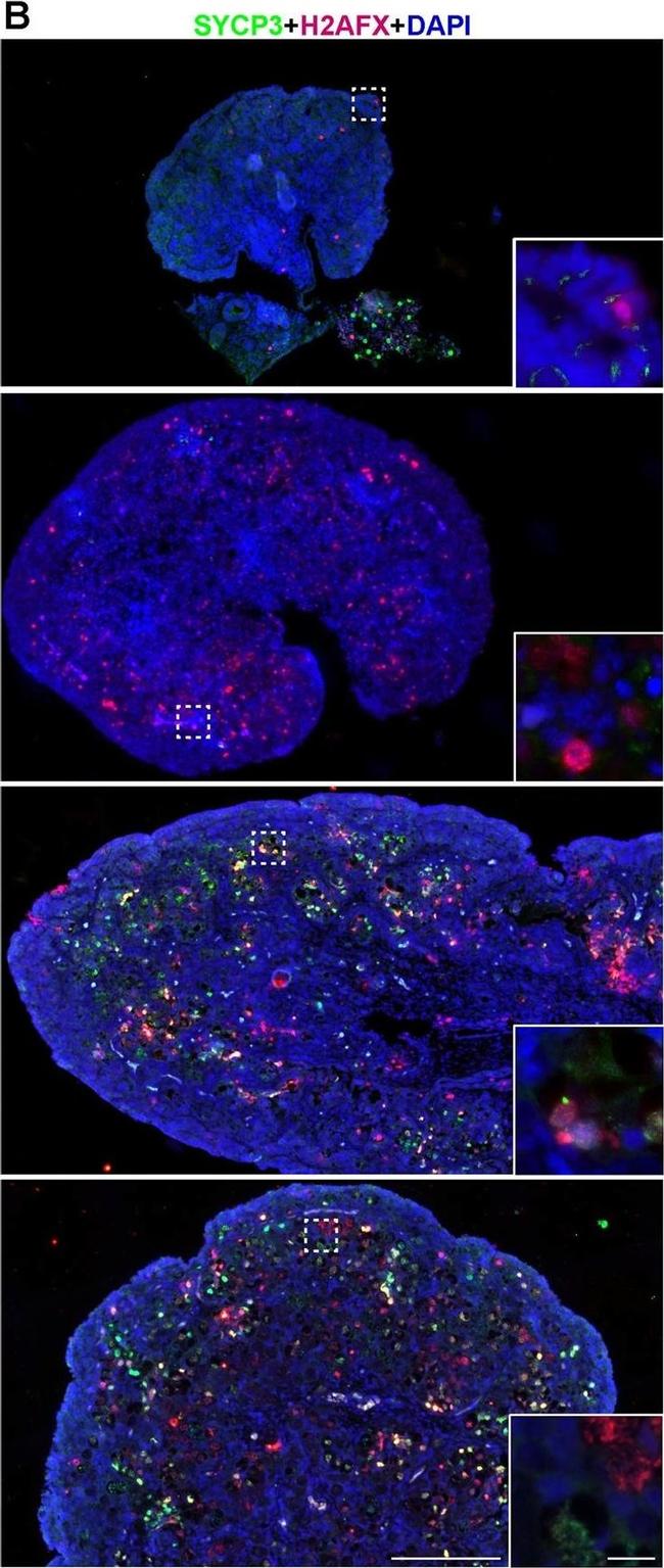 Mouse IgG (H+L) Highly Cross-Adsorbed Secondary Antibody in Immunohistochemistry (IHC)