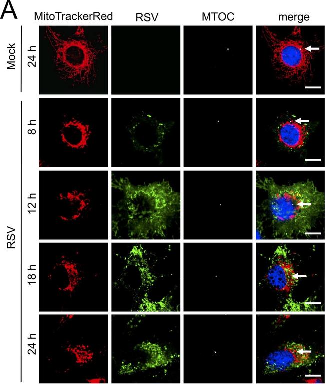 Goat IgG (H+L) Cross-Adsorbed Secondary Antibody in Immunocytochemistry (ICC/IF)