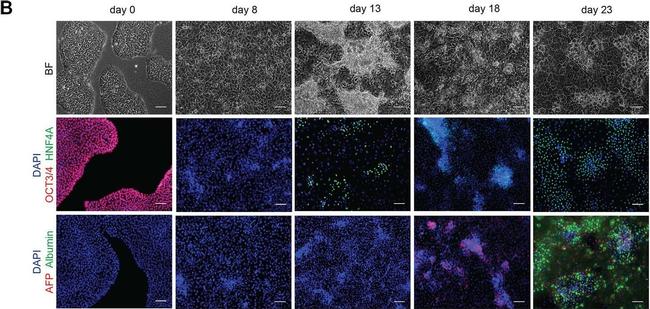 Goat IgG (H+L) Cross-Adsorbed Secondary Antibody in Immunocytochemistry (ICC/IF)