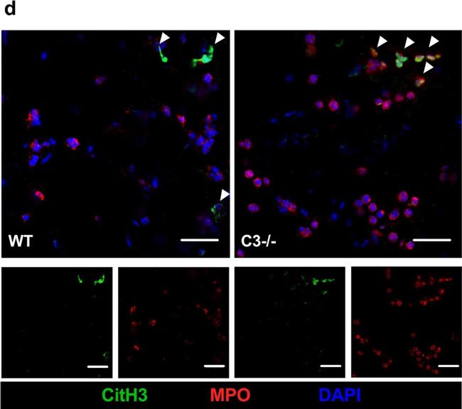 Goat IgG (H+L) Cross-Adsorbed Secondary Antibody in Immunocytochemistry (ICC/IF)