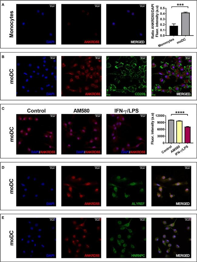 Rabbit IgG (H+L) Cross-Adsorbed Secondary Antibody in Immunocytochemistry (ICC/IF)