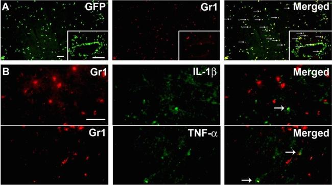 Rat IgG (H+L) Cross-Adsorbed Secondary Antibody in Immunohistochemistry (Frozen) (IHC (F))