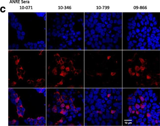 Human IgG (H+L) Cross-Adsorbed Secondary Antibody in Immunocytochemistry (ICC/IF)