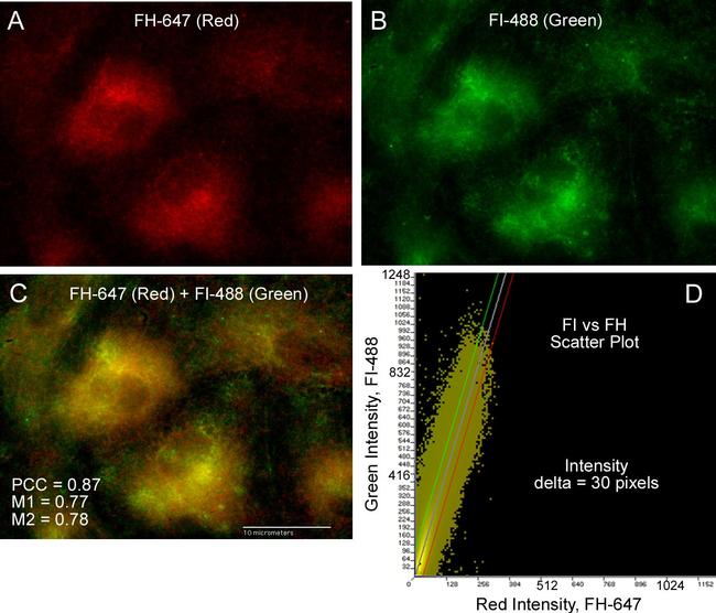 Mouse IgG (H+L) Cross-Adsorbed Secondary Antibody in Immunocytochemistry (ICC/IF)