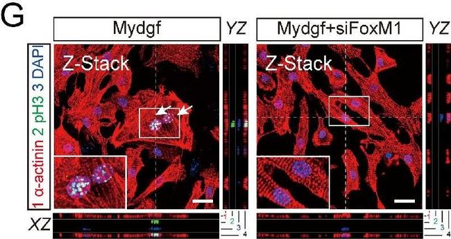 Mouse IgG (H+L) Highly Cross-Adsorbed Secondary Antibody in Immunohistochemistry (IHC)