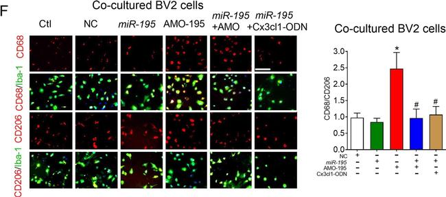 Mouse IgG (H+L) Highly Cross-Adsorbed Secondary Antibody in Immunocytochemistry (ICC/IF)