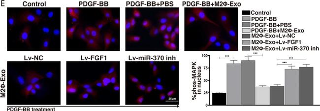 Mouse IgG (H+L) Highly Cross-Adsorbed Secondary Antibody in Immunocytochemistry (ICC/IF)