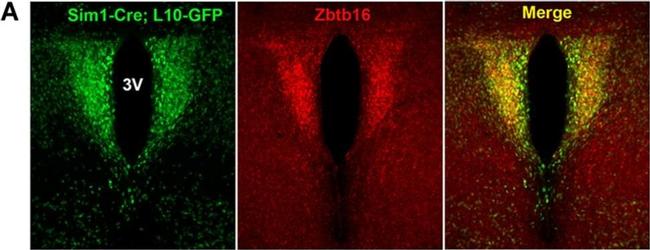 Rabbit IgG (H+L) Highly Cross-Adsorbed Secondary Antibody in Immunohistochemistry (Frozen) (IHC (F))