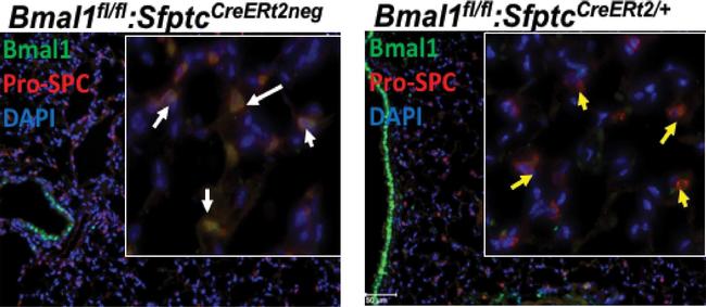 Rabbit IgG (H+L) Highly Cross-Adsorbed Secondary Antibody in Immunohistochemistry (Paraffin) (IHC (P))