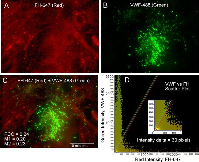 Rabbit IgG (H+L) Cross-Adsorbed Secondary Antibody in Immunocytochemistry (ICC/IF)