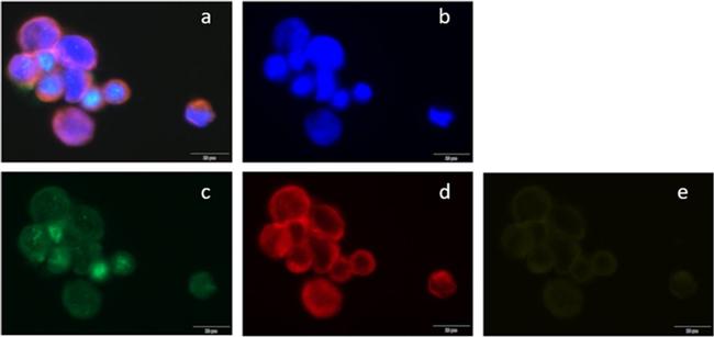 Rat IgG (H+L) Cross-Adsorbed Secondary Antibody in Immunocytochemistry (ICC/IF)