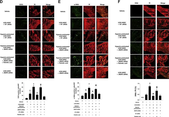 Rabbit IgG (H+L) Highly Cross-Adsorbed Secondary Antibody in Immunohistochemistry (IHC)