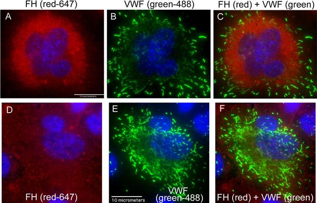 Rabbit IgG (H+L) Cross-Adsorbed Secondary Antibody in Immunocytochemistry (ICC/IF)