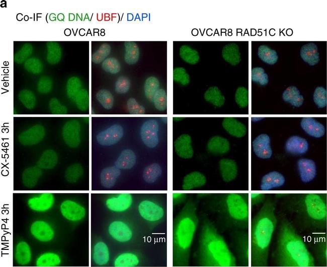 Mouse IgG (H+L) Highly Cross-Adsorbed Secondary Antibody in Immunocytochemistry (ICC/IF)