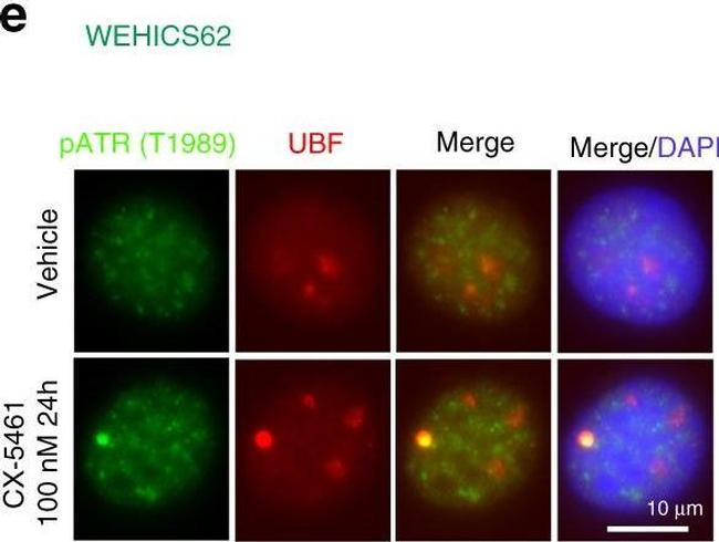 Mouse IgG (H+L) Highly Cross-Adsorbed Secondary Antibody in Immunocytochemistry (ICC/IF)