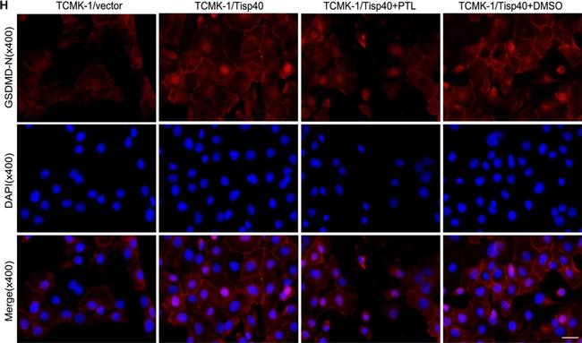 Rabbit IgG (H+L) Highly Cross-Adsorbed Secondary Antibody in Immunocytochemistry (ICC/IF)