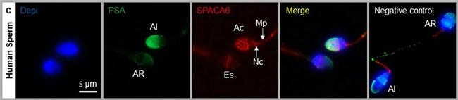 Rabbit IgG (H+L) Highly Cross-Adsorbed Secondary Antibody in Immunocytochemistry (ICC/IF)