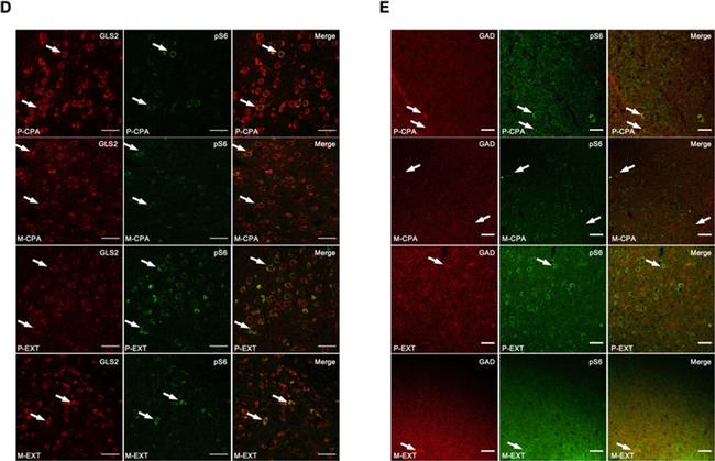 Sheep IgG (H+L) Cross-Adsorbed Secondary Antibody in Immunohistochemistry (IHC)