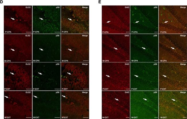 Sheep IgG (H+L) Cross-Adsorbed Secondary Antibody in Immunohistochemistry (IHC)