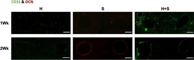 Mouse IgG1 Cross-Adsorbed Secondary Antibody in Immunocytochemistry (ICC/IF)