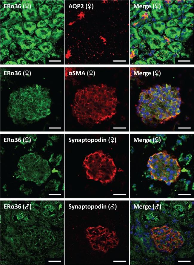 Mouse IgG (H+L) Highly Cross-Adsorbed Secondary Antibody in Immunohistochemistry (Frozen) (IHC (F))