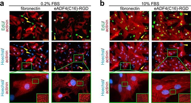 Mouse IgG (H+L) Highly Cross-Adsorbed Secondary Antibody in Immunocytochemistry (ICC/IF)