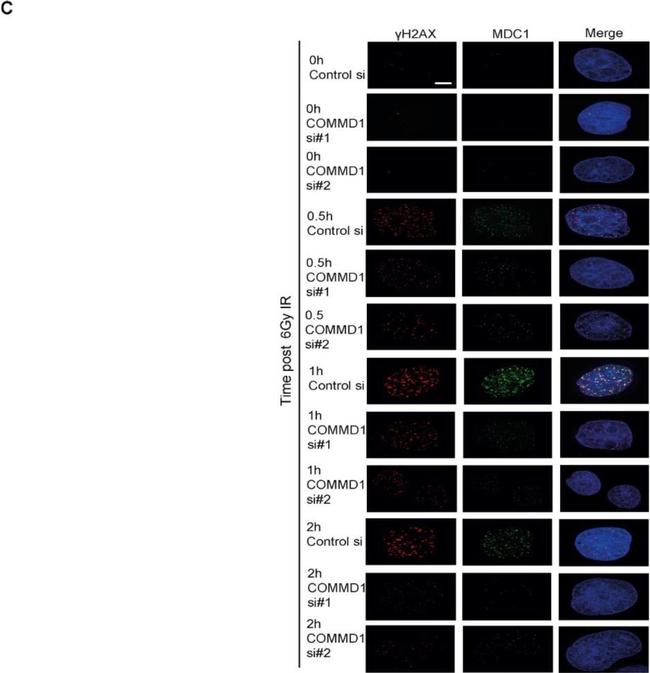 Mouse IgG (H+L) Highly Cross-Adsorbed Secondary Antibody in Immunocytochemistry (ICC/IF)